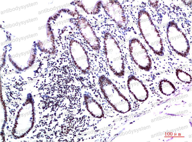 Валидация AntibodySystem RHG43407 (2945)