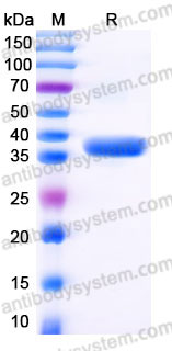 EHC21302, SDS-PAGE