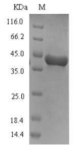 SDS-PAGE