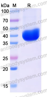 EHK63501, SDS-PAGE