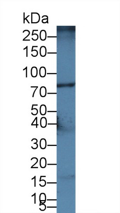 14382