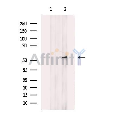 Валидация Affinity DF12081 - 6167