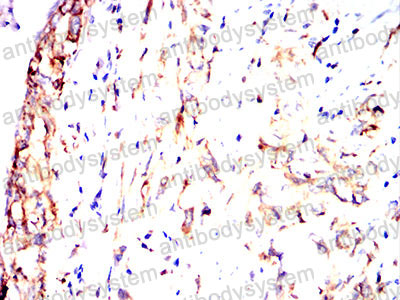 Валидация AntibodySystem RHM01701 (3767)