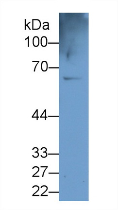 21395