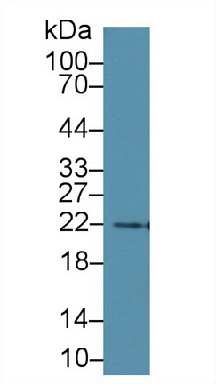 14855