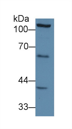 12652