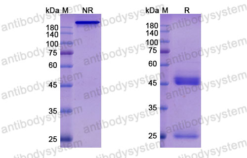 Валидация SDS-PAGE - AntibodySystem DHA29106