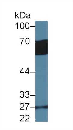 14406