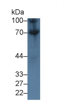13992