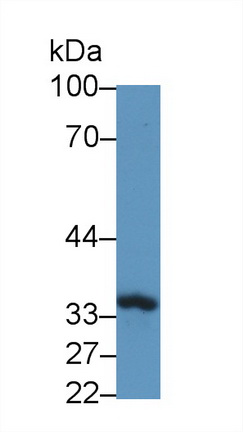 14188