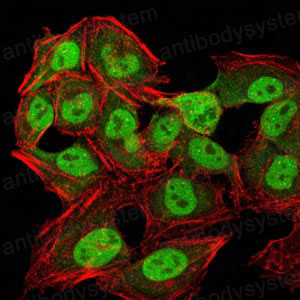 Валидация IF - AntibodySystem RHF75404