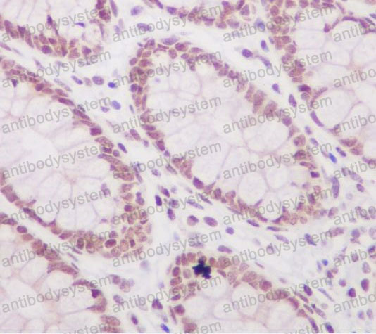 Валидация AntibodySystem RHF62715