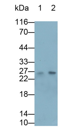 14744