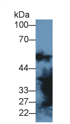 14476