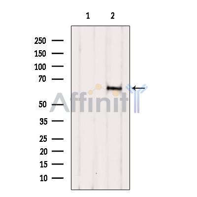 Валидация Affinity DF9272 - 21715