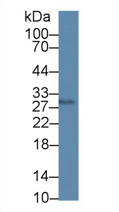 12661