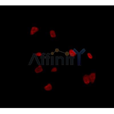 Валидация Affinity DF4657 - 16315