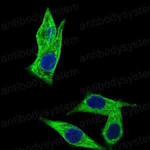 Валидация IF - AntibodySystem RHP00101