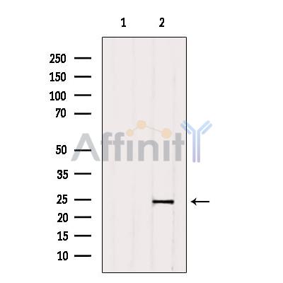 Валидация Affinity DF4047 - 15308