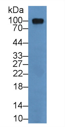 11981