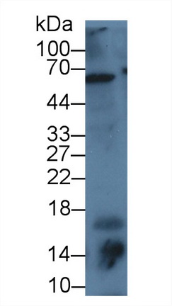 14740