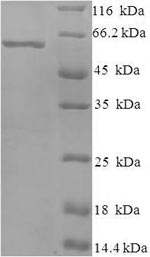 SDS-PAGE