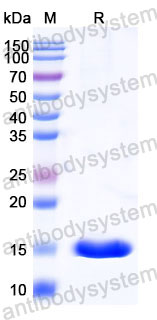 Валидация SDS-PAGE - AntibodySystem RHC05301