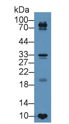 9107