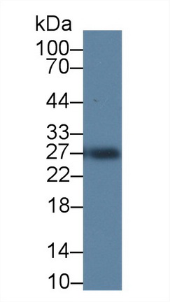 14725