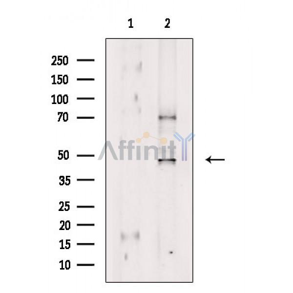 Валидация Affinity AF9081 - 4848
