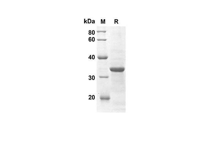 SDS-PAGE, Ccl25, мышиный