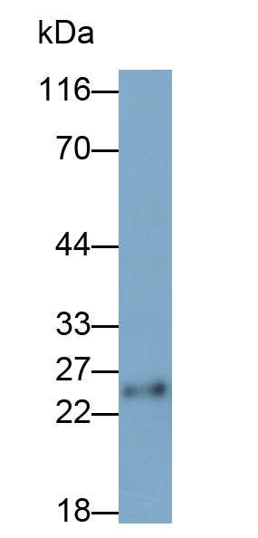 31671