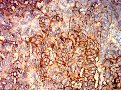 Валидация AntibodySystem RHD17407 (1390)