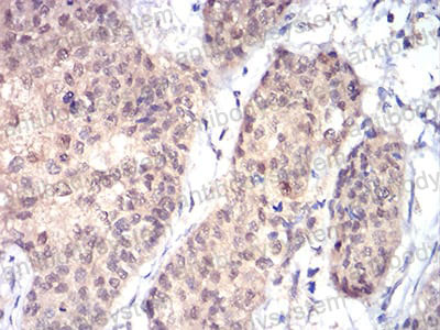 Валидация AntibodySystem RHF04602 (2442)