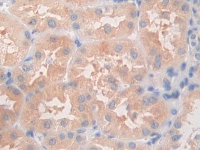 11851