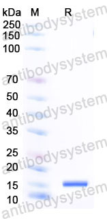 Валидация SDS-PAGE - AntibodySystem RHH02201