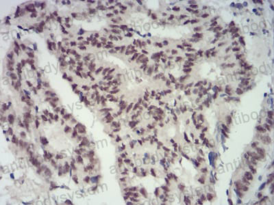 Валидация AntibodySystem RHA07304
