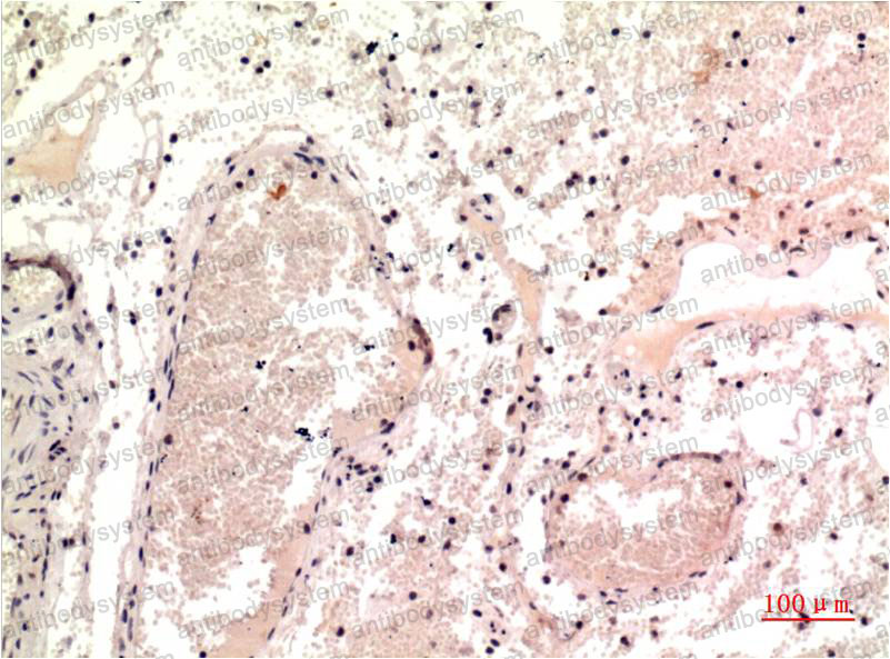Валидация AntibodySystem RHD56204 (1644)