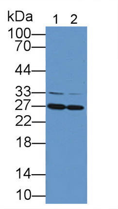 11914