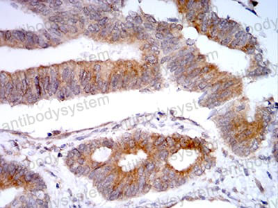 Валидация AntibodySystem RHN95701 (3995)