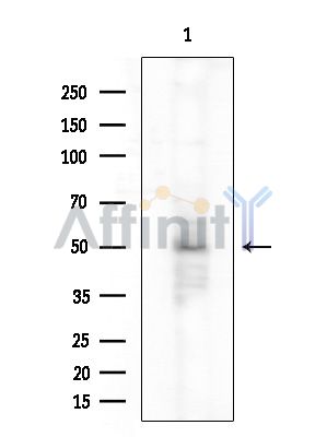 Валидация Affinity DF6418 - 17785