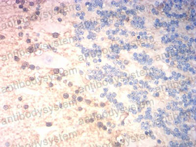 Валидация AntibodySystem RHC08403