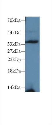 14560