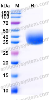 EHJ55601, SDS-PAGE