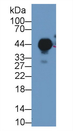 14166