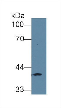 12665