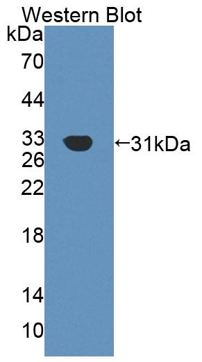 59320