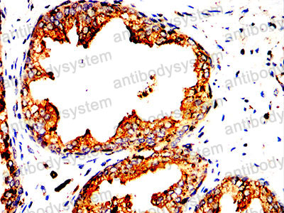 Валидация AntibodySystem RHC87703