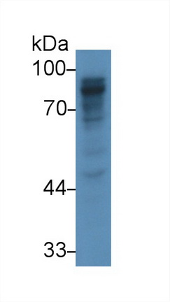 14918