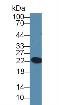 17637